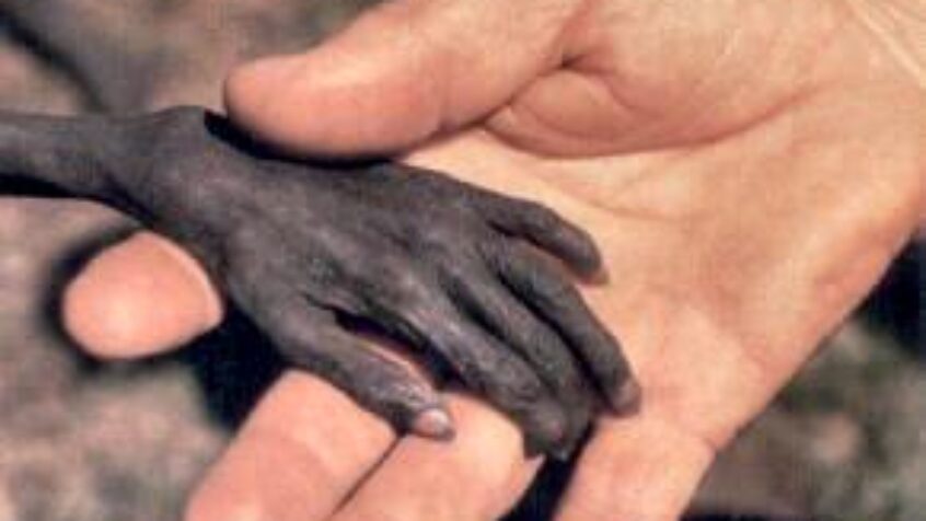 1 million d&rsquo;enfants au Sahel vont bientôt mourir…