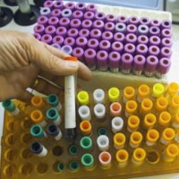 Immunothérapie
