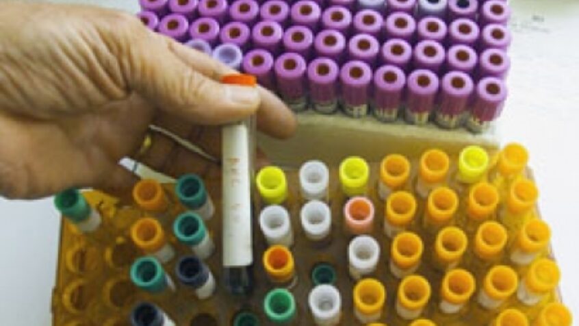 Une thérapie révolutionnaire contre le cancer menacée