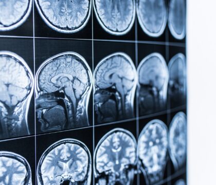 Enseignement et neurosciences : La révolution de l&rsquo;apprentissage