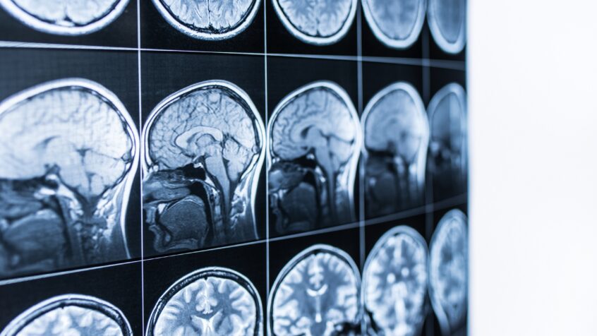 Enseignement et neurosciences : La révolution de l&rsquo;apprentissage