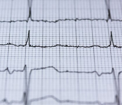 Euthanasie: en France, l&rsquo;avis du comité national d&rsquo;éthique relance le débat