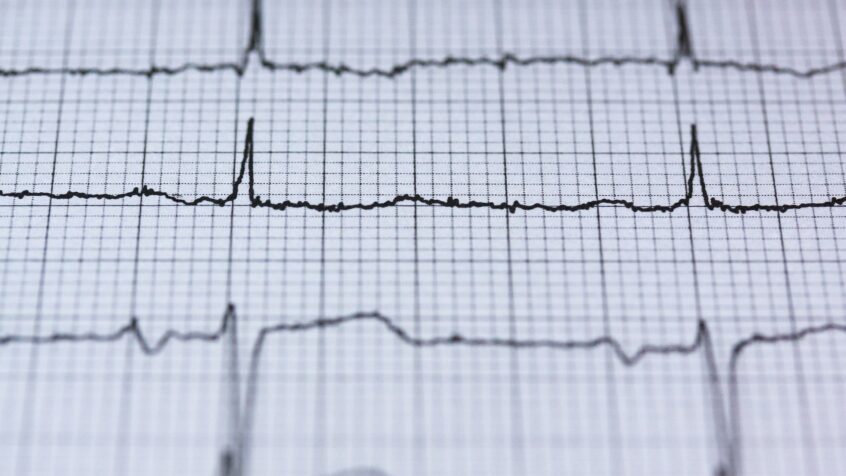 Euthanasie: en France, l&rsquo;avis du comité national d&rsquo;éthique relance le débat