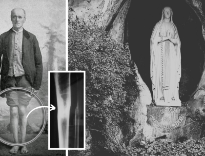 Un arbre lui broie la jambe, huit ans plus tard il se lève et marche: découvrez le 1er épisode de notre série d&rsquo;été « Les miracles à la belge »
